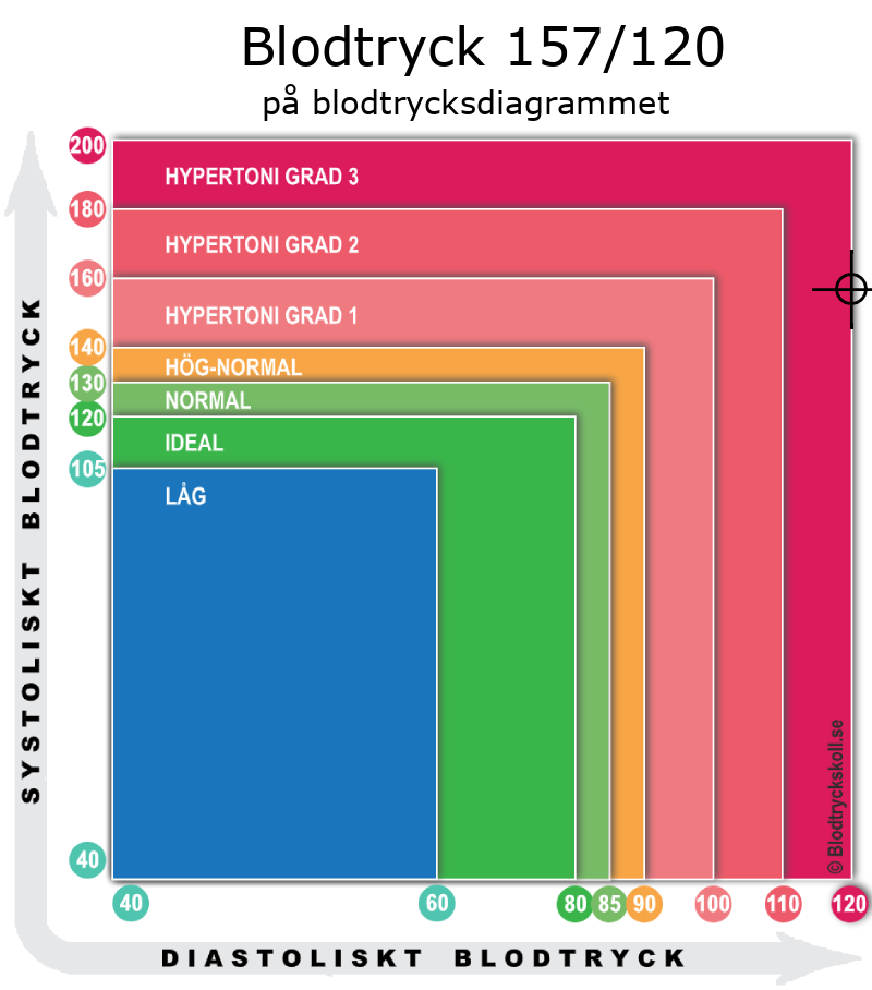 Blodtryck 157 över 122 på blodtrycksdiagram