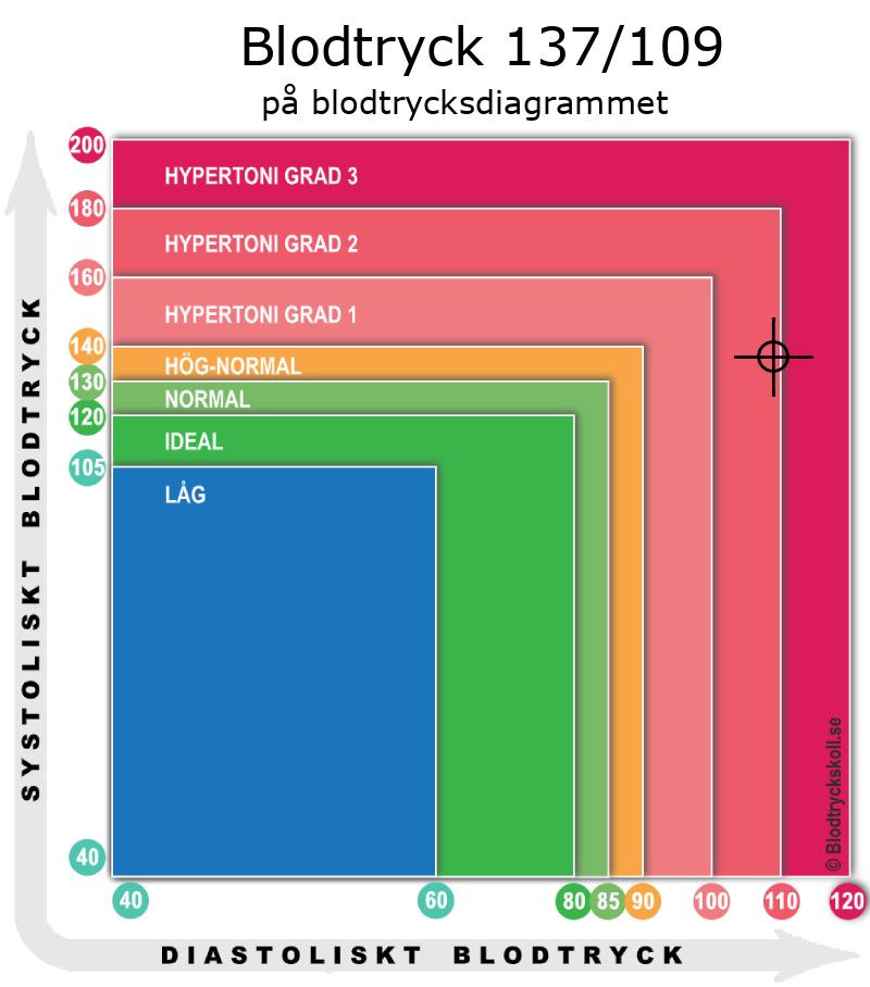 Blodtryck 137 över 109 på blodtrycksdiagram