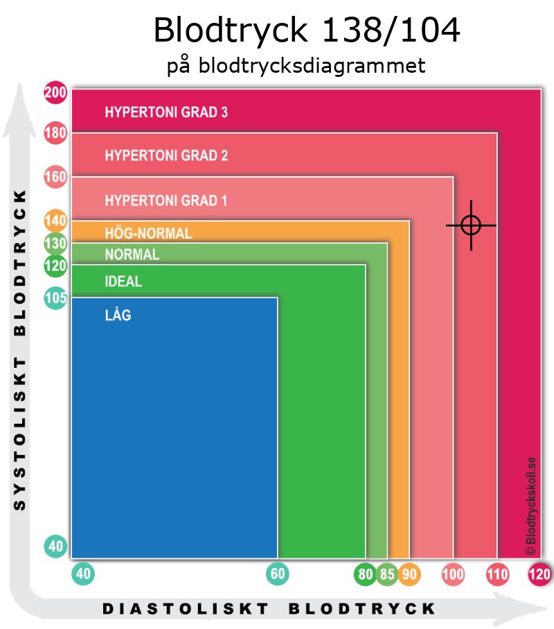 Blodtryck 138 över 104 på blodtrycksdiagram