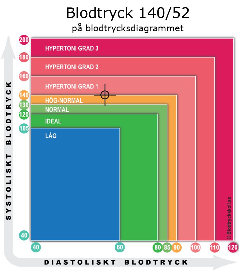 Blodtryck 140 över 52 på blodtrycksdiagram