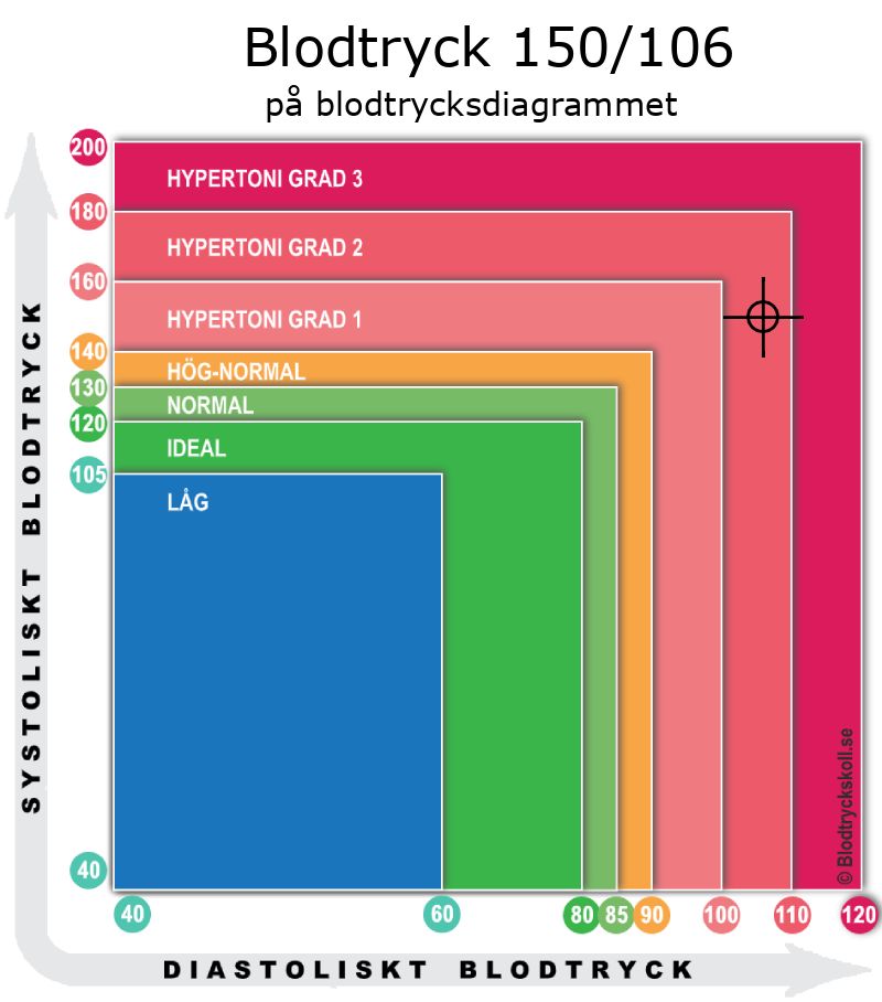 Blodtryck 150 över 106 på blodtrycksdiagram