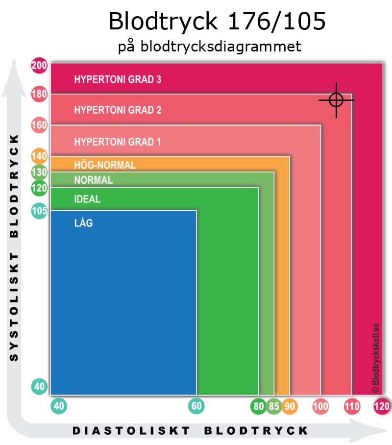 Blodtryck 176 över 105 på blodtrycksdiagram