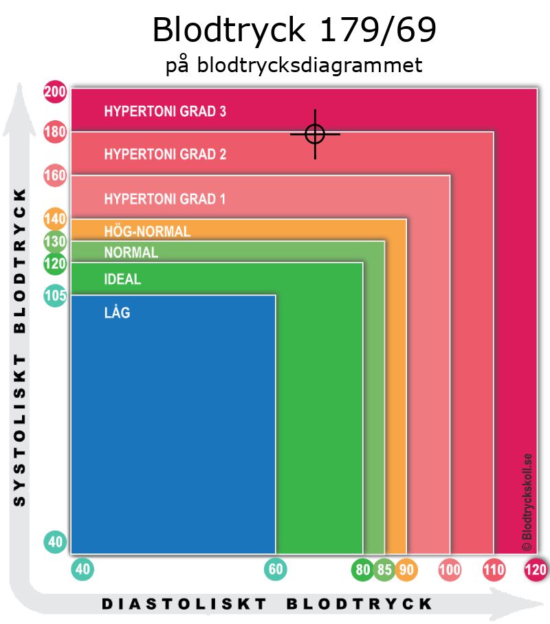 Blodtryck 179 över 69 på blodtrycksdiagram