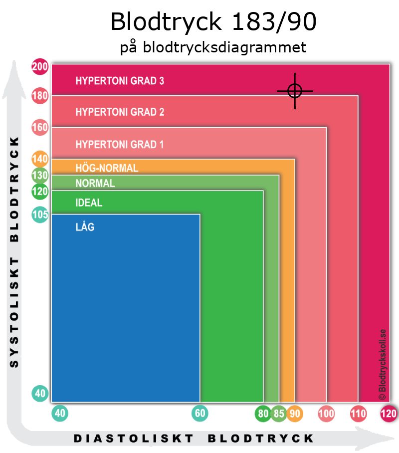 Blodtryck 183 över 90 på blodtrycksdiagram