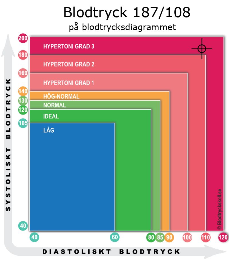 Blodtryck 187 över 108 på blodtrycksdiagram
