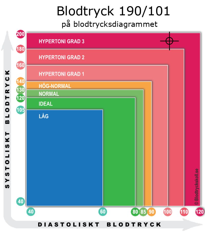 Blodtryck 190 över 101 på blodtrycksdiagram