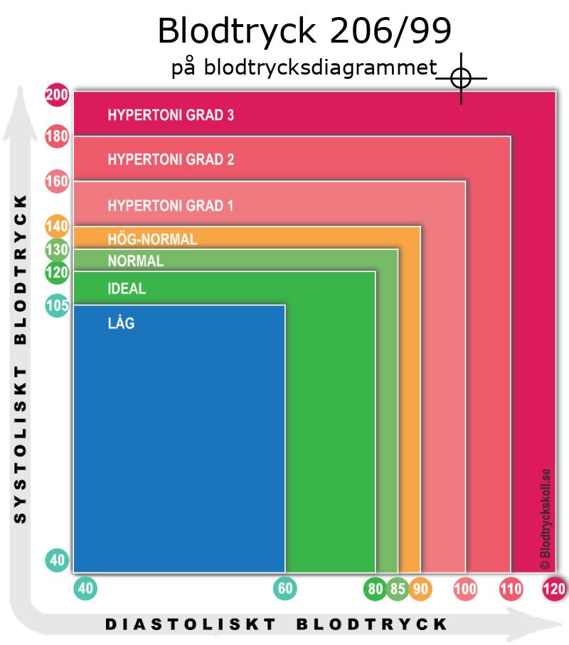 Blodtryck 206 över 99 på blodtrycksdiagram