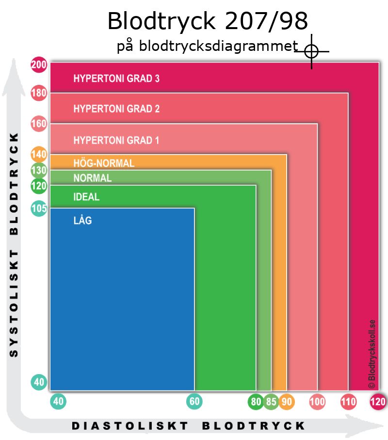 Blodtryck 207 över 98 på blodtrycksdiagram