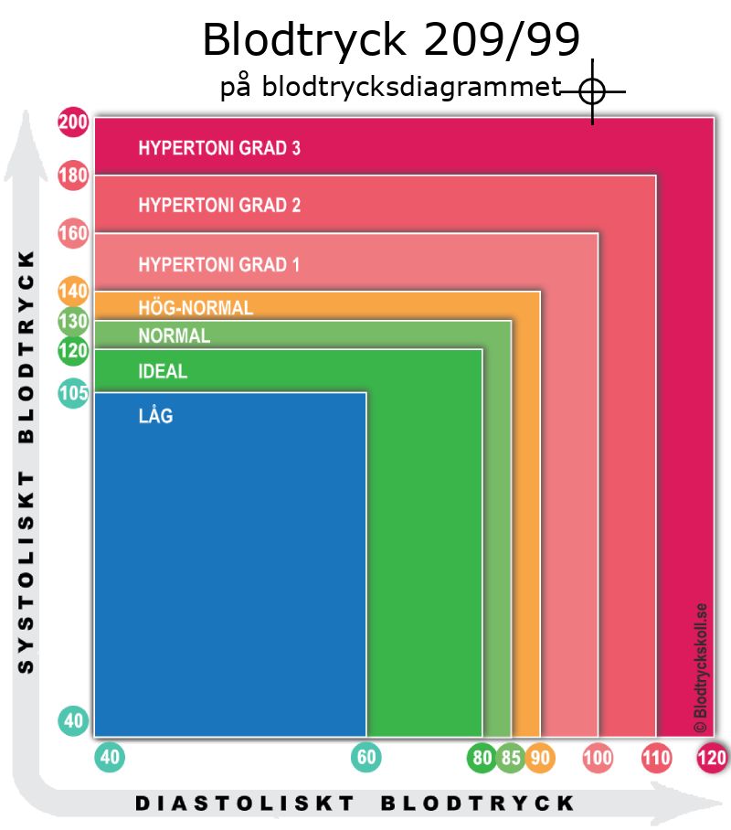 Blodtryck 209 över 99 på blodtrycksdiagram