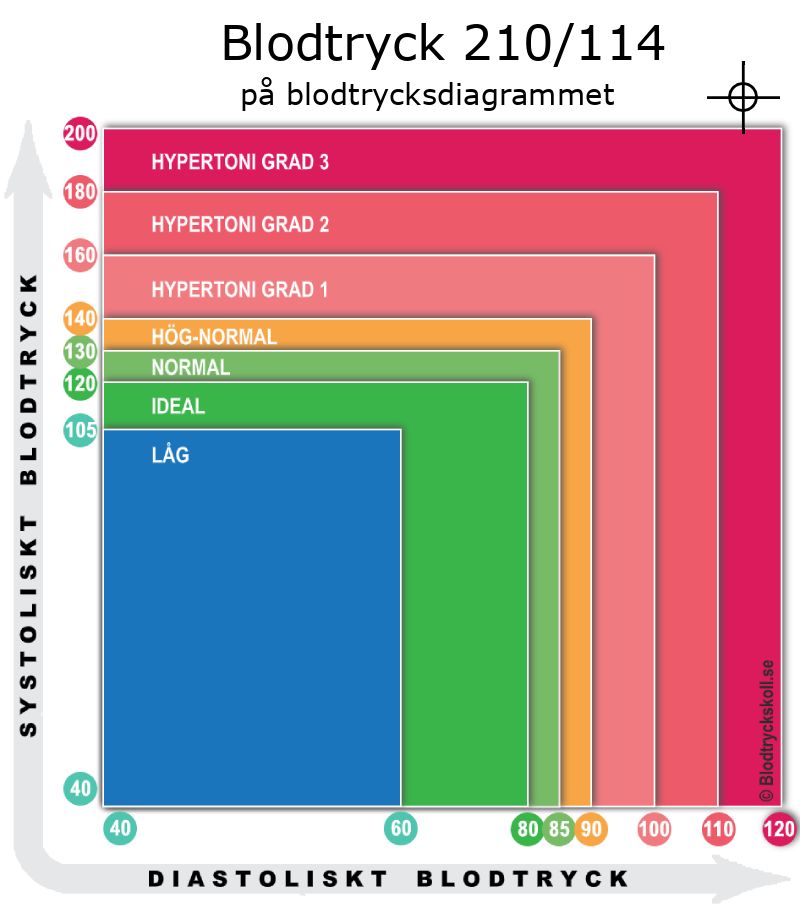 Blodtryck 210 över 114 på blodtrycksdiagram