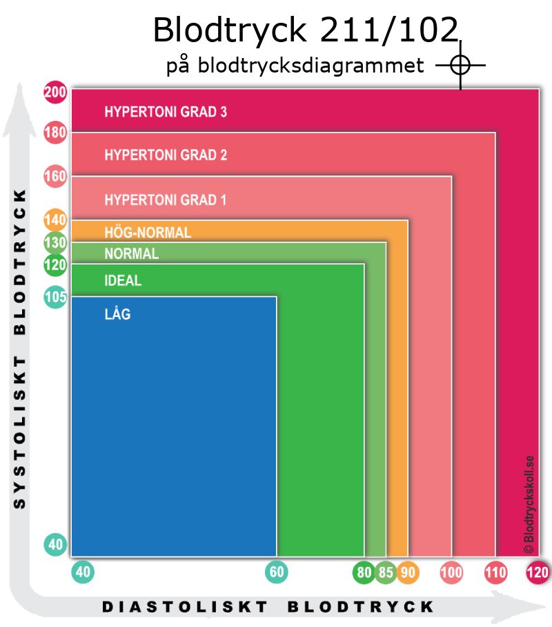 Blodtryck 211 över 102 på blodtrycksdiagram