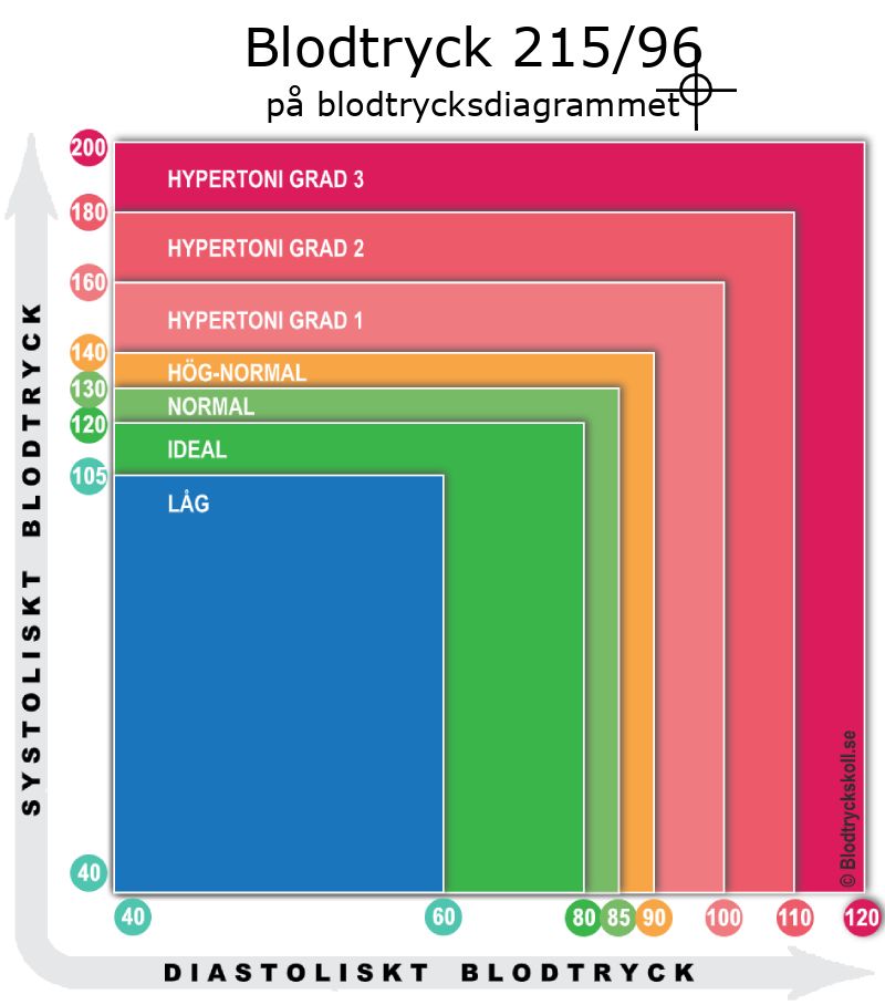 Blodtryck 215 över 96 på blodtrycksdiagram