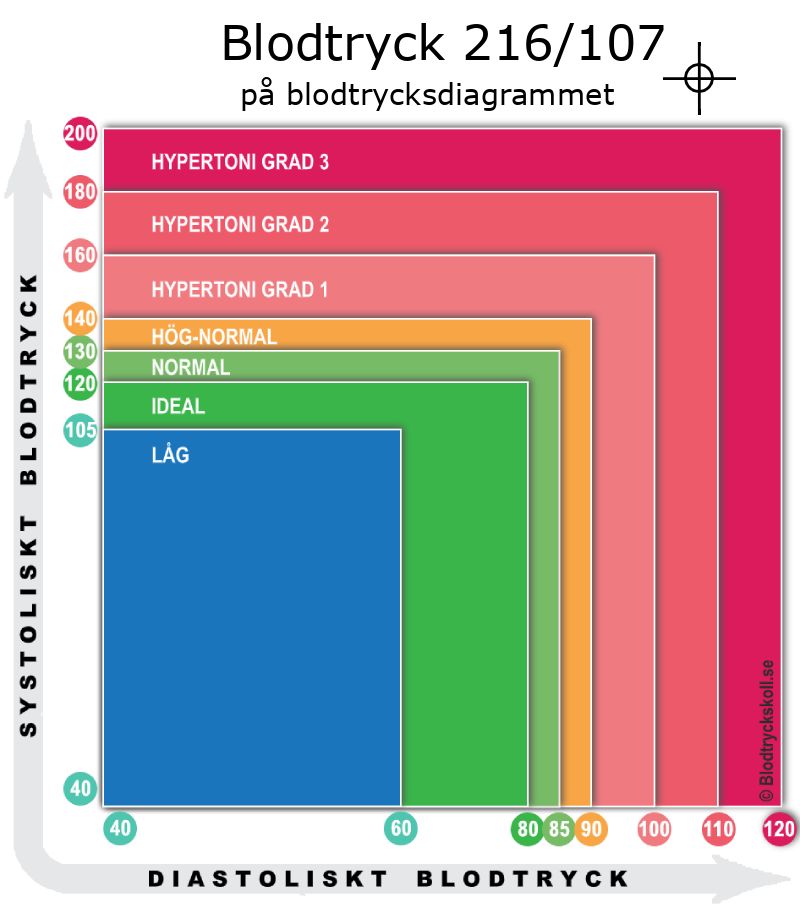 Blodtryck 216 över 107 på blodtrycksdiagram