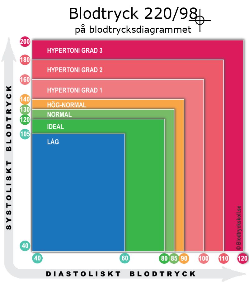 Blodtryck 220 över 98 på blodtrycksdiagram