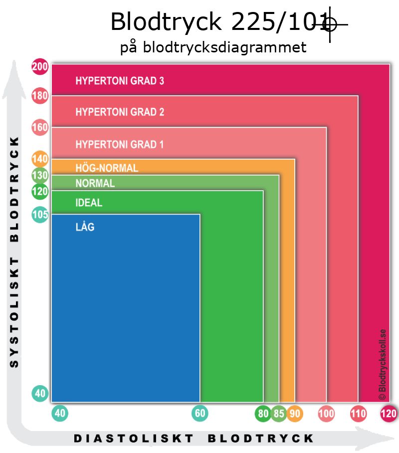 Blodtryck 225 över 101 på blodtrycksdiagram