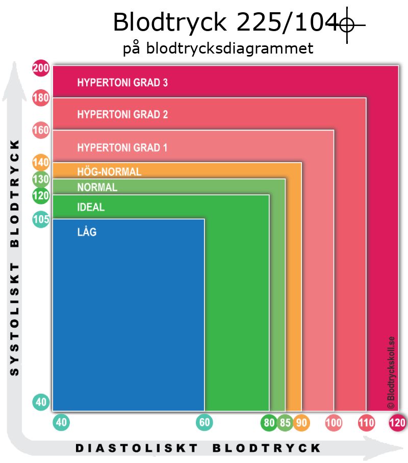 Blodtryck 225 över 104 på blodtrycksdiagram