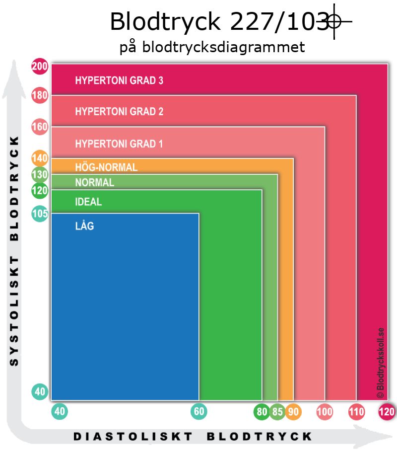 Blodtryck 227 över 103 på blodtrycksdiagram