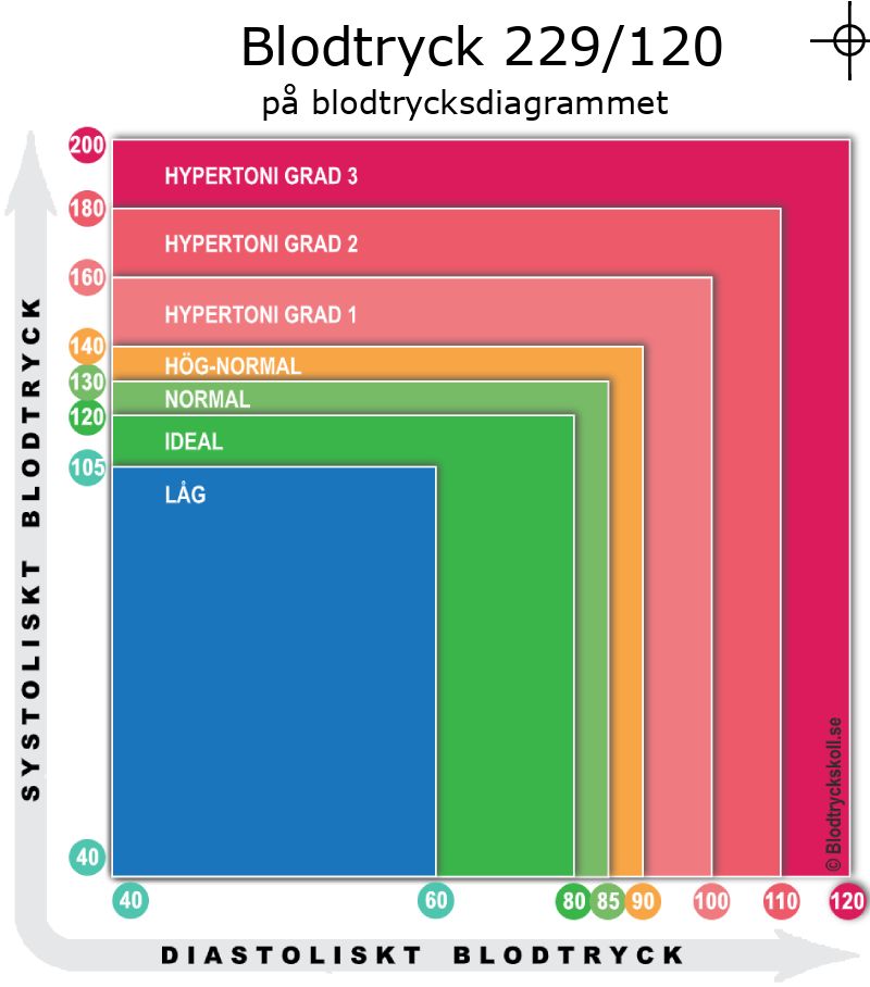 Blodtryck 229 över 120 på blodtrycksdiagram