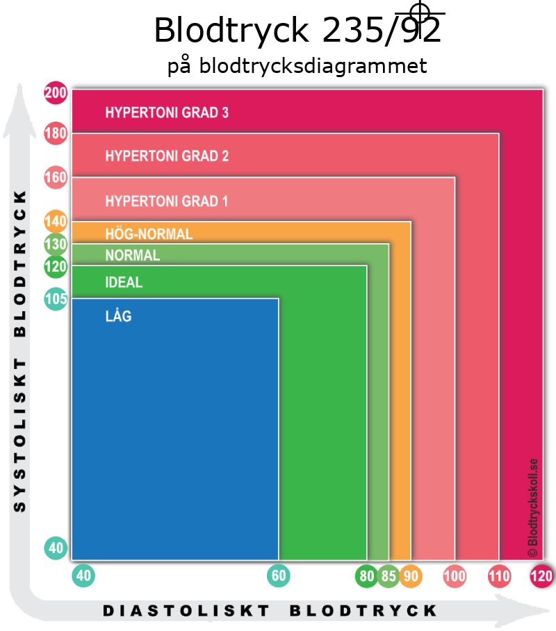 Blodtryck 235 över 92 på blodtrycksdiagram