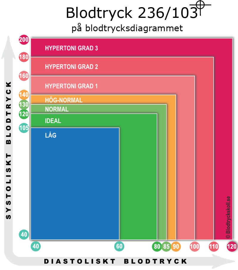 Blodtryck 236 över 103 på blodtrycksdiagram