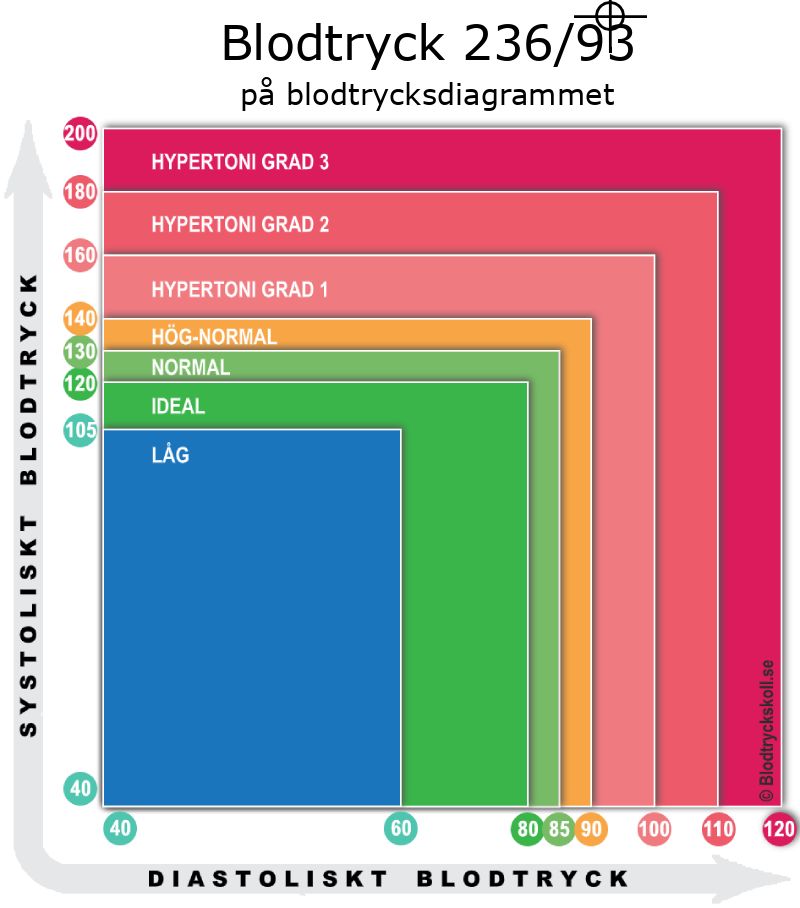 Blodtryck 236 över 93 på blodtrycksdiagram