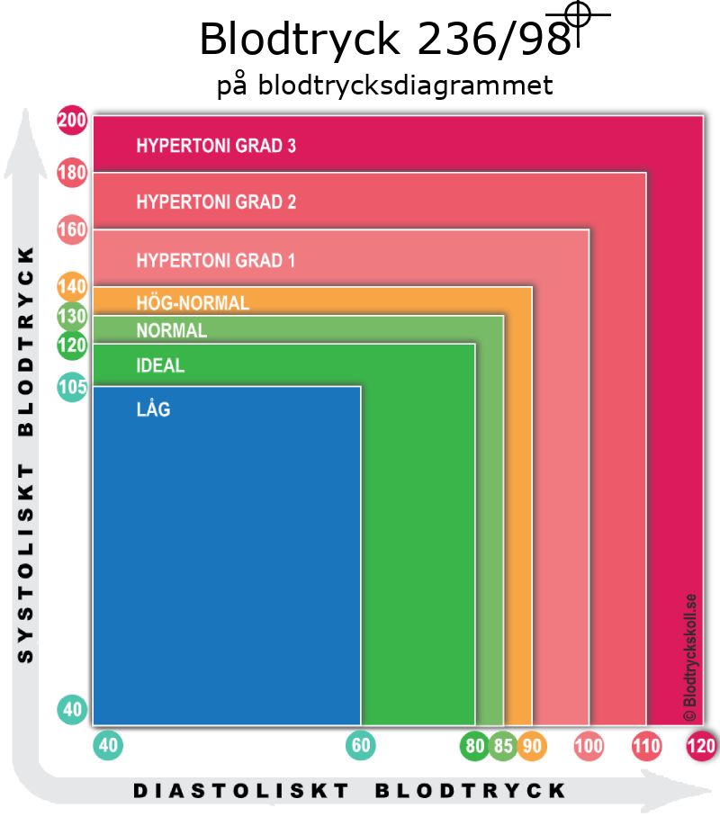 Blodtryck 236 över 98 på blodtrycksdiagram