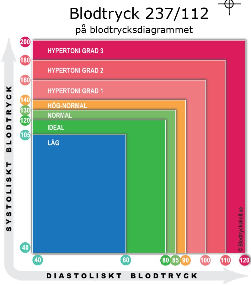 Blodtryck 237 över 112 på blodtrycksdiagram