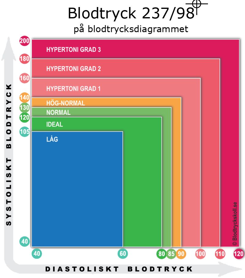Blodtryck 237 över 98 på blodtrycksdiagram