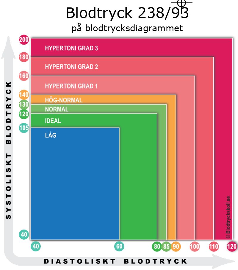 Blodtryck 238 över 93 på blodtrycksdiagram