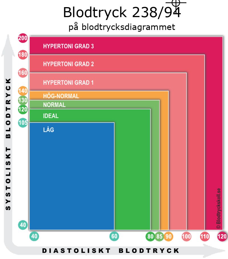 Blodtryck 238 över 94 på blodtrycksdiagram