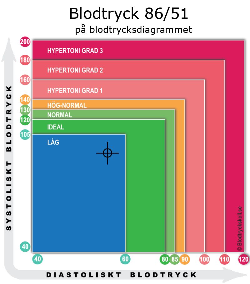 Blodtryck 86 över 51 på blodtrycksdiagram